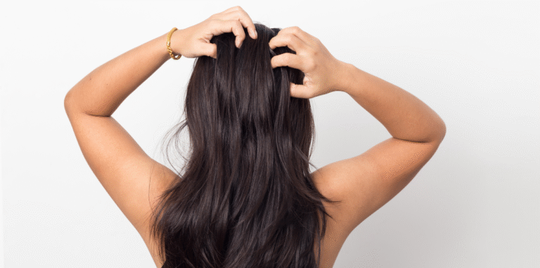 Microneedling for Hair Regrowth: what to know before you book