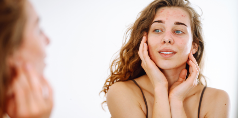 Why Your Face Looks Tired Even When You’re Not